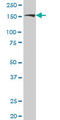 Rho Associated Coiled-Coil Containing Protein Kinase 2 antibody, LS-B4486, Lifespan Biosciences, Western Blot image 