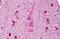 Insulin Receptor Substrate 1 antibody, MBS241289, MyBioSource, Immunohistochemistry paraffin image 