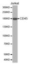 CD45 antibody, STJ110946, St John