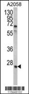 Growth Factor Receptor Bound Protein 2 antibody, MBS9211528, MyBioSource, Western Blot image 