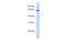 Zinc Finger Protein 280B antibody, 25-554, ProSci, Enzyme Linked Immunosorbent Assay image 