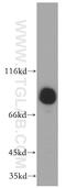 EPS8 Like 2 antibody, 20461-1-AP, Proteintech Group, Western Blot image 