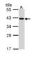 Eukaryotic Translation Initiation Factor 2B Subunit Beta antibody, TA308277, Origene, Western Blot image 