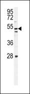 MTOR Associated Protein, Eak-7 Homolog antibody, 55-233, ProSci, Western Blot image 