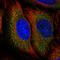 TSC Complex Subunit 2 antibody, HPA049679, Atlas Antibodies, Immunofluorescence image 