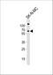 Protein Phosphatase 2 Regulatory Subunit B'Beta antibody, A09894-1, Boster Biological Technology, Western Blot image 