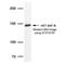 Scaffold Attachment Factor B antibody, GTX70197, GeneTex, Western Blot image 