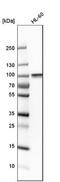 Rac/Cdc42 Guanine Nucleotide Exchange Factor 6 antibody, NBP1-89124, Novus Biologicals, Western Blot image 