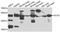 Secretogranin III antibody, A7799, ABclonal Technology, Western Blot image 