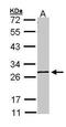 Glycerol Kinase 5 antibody, TA308147, Origene, Western Blot image 