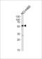 GABA(A) receptor subunit alpha-2 antibody, MBS9200768, MyBioSource, Western Blot image 