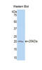 Interleukin 36 Gamma antibody, LS-C294790, Lifespan Biosciences, Western Blot image 