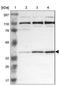 Ribosomal RNA-processing protein 7 homolog A antibody, NBP1-85647, Novus Biologicals, Western Blot image 
