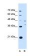 Ecotropic Viral Integration Site 2B antibody, orb325292, Biorbyt, Western Blot image 