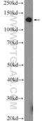 Poly(ADP-Ribose) Polymerase Family Member 10 antibody, 26072-1-AP, Proteintech Group, Western Blot image 