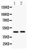 Arrestin Beta 2 antibody, PA1845, Boster Biological Technology, Western Blot image 