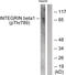 Integrin Subunit Beta 1 antibody, 79-789, ProSci, Western Blot image 