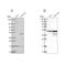 Transcription Factor AP-2 Alpha antibody, NBP2-38809, Novus Biologicals, Western Blot image 