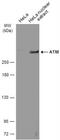 ATM Serine/Threonine Kinase antibody, NB100-220, Novus Biologicals, Western Blot image 