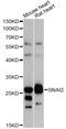 Snail Family Transcriptional Repressor 2 antibody, MBS126496, MyBioSource, Western Blot image 