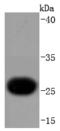 Troponin I3, Cardiac Type antibody, A01720-2, Boster Biological Technology, Western Blot image 
