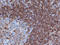 CD79a antibody, AM01322PU-T, Origene, Immunohistochemistry frozen image 