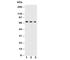 Triggering Receptor Expressed On Myeloid Cells 1 antibody, R30663, NSJ Bioreagents, Western Blot image 