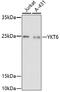 YKT6 V-SNARE Homolog antibody, 16-859, ProSci, Western Blot image 