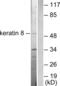 Keratin 8 antibody, abx013127, Abbexa, Western Blot image 