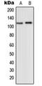 Glutamate Metabotropic Receptor 2 antibody, orb214011, Biorbyt, Western Blot image 