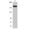 ATP Binding Cassette Subfamily A Member 6 antibody, LS-C381837, Lifespan Biosciences, Western Blot image 