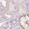 Insulin Like Growth Factor Binding Protein 1 antibody, NBP2-33599, Novus Biologicals, Immunohistochemistry frozen image 