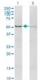 Activin A Receptor Type 2B antibody, H00000093-M03, Novus Biologicals, Western Blot image 