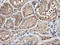 Tubulin Alpha Like 3 antibody, LS-C173531, Lifespan Biosciences, Immunohistochemistry paraffin image 