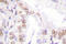 SUMO Specific Peptidase 5 antibody, LS-C176348, Lifespan Biosciences, Immunohistochemistry frozen image 