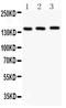 Apoptotic Peptidase Activating Factor 1 antibody, PA1249-1, Boster Biological Technology, Western Blot image 