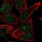 ST6 N-Acetylgalactosaminide Alpha-2,6-Sialyltransferase 6 antibody, NBP1-80751, Novus Biologicals, Immunofluorescence image 