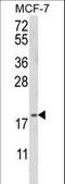 GABA Type A Receptor Associated Protein Like 2 antibody, LS-C166315, Lifespan Biosciences, Western Blot image 