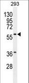 Carboxypeptidase A2 antibody, LS-C166982, Lifespan Biosciences, Western Blot image 