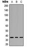 G Protein-Coupled Bile Acid Receptor 1 antibody, LS-C354383, Lifespan Biosciences, Western Blot image 