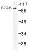 Chloride Voltage-Gated Channel 6 antibody, AP01392PU-N, Origene, Western Blot image 