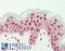 HNF1 Homeobox B antibody, LS-B14000, Lifespan Biosciences, Immunohistochemistry paraffin image 