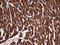 TNNI1 antibody, LS-C340307, Lifespan Biosciences, Immunohistochemistry frozen image 