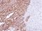 Farnesyl-Diphosphate Farnesyltransferase 1 antibody, GTX108885, GeneTex, Immunohistochemistry paraffin image 