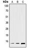 Trefoil Factor 2 antibody, MBS820223, MyBioSource, Western Blot image 