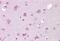 Transient Receptor Potential Cation Channel Subfamily M Member 7 antibody, MBS247015, MyBioSource, Immunohistochemistry paraffin image 