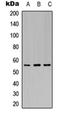 G protein-activated inward rectifier potassium channel 1 antibody, orb315577, Biorbyt, Western Blot image 