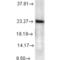 Prostaglandin E Synthase 3 antibody, M04136-1, Boster Biological Technology, Western Blot image 
