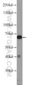 ER Degradation Enhancing Alpha-Mannosidase Like Protein 2 antibody, 11241-1-AP, Proteintech Group, Western Blot image 