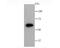 Glucose-6-Phosphate Dehydrogenase antibody, NBP2-66870, Novus Biologicals, Western Blot image 